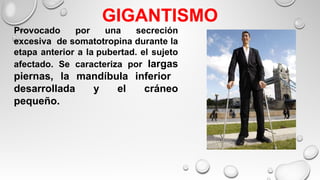 GIGANTISMO
Provocado por una secreción
excesiva de somatotropina durante la
etapa anterior a la pubertad. el sujeto
afectado. Se caracteriza por largas
piernas, la mandíbula inferior
desarrollada y el cráneo
pequeño.
 
