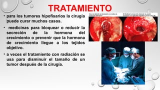 TRATAMIENTO
• para los tumores hipofisarios la cirugía
puede curar muchos casos.
• medicinas para bloquear o reducir la
secreción de la hormona del
crecimiento o prevenir que la hormona
de crecimiento llegue a los tejidos
objetivo.
• a veces el tratamiento con radiación se
usa para disminuir el tamaño de un
tumor después de la cirugía.
 