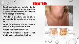 BOCIO
Es el aumento de tamaño de la
glándula tiroides o tumoración en
la parte antero-inferior del cuello
justo debajo de la laringe.
• Grado I : glándula que se palpa
aumentada de tamaño pero no se
ve
•Grado II: glándula que se palpa y
se ve a la inspección de cuello
•Grado III: deforma el cuello
•Grado IV: deforma el cuello a tal
grado que se visualiza de atrás.
 