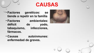 CAUSAS
• Factores genéticos: se
tiende a repetir en la familia
• Factores ambientales:
déficit de yodo,
tabaquismo, infecciones,
fármacos.
• Causas autoinmunes:
enfermedad de graves.
 
