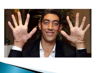 Sistema endócrino parte 1