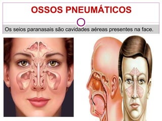 OSSOS PNEUMÁTICOS
Os seios paranasais são cavidades aéreas presentes na face.