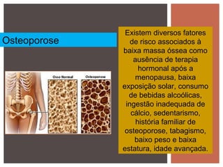 Existem diversos fatores
de risco associados à
baixa massa óssea como
ausência de terapia
hormonal após a
menopausa, baixa
exposição solar, consumo
de bebidas alcoólicas,
ingestão inadequada de
cálcio, sedentarismo,
história familiar de
osteoporose, tabagismo,
baixo peso e baixa
estatura, idade avançada.
Osteoporose
 