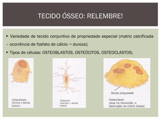 TECIDO ÓSSEO: RELEMBRE!
► Variedade de tecido conjuntivo de propriedade especial (matriz calcificada
– ocorrência de fosfato de cálcio → dureza);
► Tipos de células: OSTEOBLASTOS, OSTEÓCITOS, OSTEOCLASTOS;
 