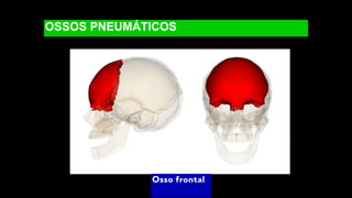 OSSOS PNEUMÁTICOS
Osso frontal
 