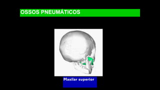 OSSOS PNEUMÁTICOS
Maxilar superior
 