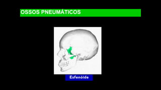 OSSOS PNEUMÁTICOS
Esfenóide
 