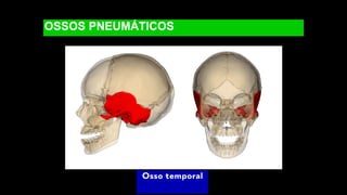 OSSOS PNEUMÁTICOS
Osso temporal
 