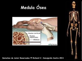Medula Ósea




Derechos de Autor Reservados © Richard C. Concepción Castro 2011
 