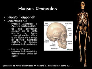 Huesos Craneales
 • Hueso Temporal:
 • Importancia AR:
     – Proceso Mastoideo o
       Apófisis mastoides (2):
     – Es      una    proyección
       circular de la parte
       inferior     del    hueso
       temporal medial sólo a
       la del lóbulo de la oreja.
       El apófisis mastoides
       sostiene el músculo
       esternocleidomastoideo
       .
     – Los dos músculos
       esternocleidomastoideo
       determinan el ancho del
       cuello.



Derechos de Autor Reservados © Richard C. Concepción Castro 2011
 