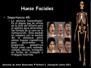 Hueso Faciales
 • Importancia AR:
     – La anchura bimandibular:
       Es el ángulo que se utiliza
       en la foto del difunto para
       el análisis para determinar
       las formas de la cara en la
       restauración. Esta medida
       se compara con la medida
       del la distancia entre
       ambos huesos cigomáticos
       para      determinar      la
       proporción       geométrica
       facial como cara redonda,
       ovalada, oblicua, triangular
       en forma de triángulo o
       triángulo invertido.


Derechos de Autor Reservados © Richard C. Concepción Castro 2011
 