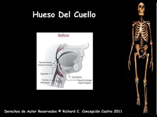 Hueso Del Cuello




Derechos de Autor Reservados © Richard C. Concepción Castro 2011
 