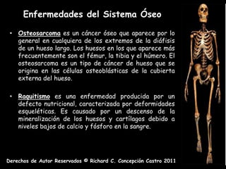 Enfermedades del Sistema Óseo

 • Osteosarcoma es un cáncer óseo que aparece por lo
   general en cualquiera de los extremos de la diáfisis
   de un hueso largo. Los huesos en los que aparece más
   frecuentemente son el fémur, la tibia y el húmero. El
   osteosarcoma es un tipo de cáncer de hueso que se
   origina en las células osteoblásticas de la cubierta
   externa del hueso.

 • Raquitismo es una enfermedad producida por un
   defecto nutricional, caracterizada por deformidades
   esqueléticas. Es causado por un descenso de la
   mineralización de los huesos y cartílagos debido a
   niveles bajos de calcio y fósforo en la sangre.




Derechos de Autor Reservados © Richard C. Concepción Castro 2011
 