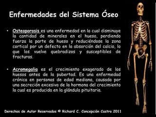 Enfermedades del Sistema Óseo

 • Osteoporosis es una enfermedad en la cual disminuye
   la cantidad de minerales en el hueso, perdiendo
   fuerza la parte de hueso y reduciéndose la zona
   cortical por un defecto en la absorción del calcio, lo
   que los vuelve quebradizos y susceptibles de
   fracturas.

 • Acromegalia es el crecimiento exagerado de los
   huesos antes de la pubertad. Es una enfermedad
   crónica en personas de edad mediana, causada por
   una secreción excesiva de la hormona del crecimiento
   la cual es producida en la glándula pituitaria.



Derechos de Autor Reservados © Richard C. Concepción Castro 2011
 