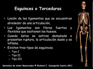 Esguinces o Torceduras

 • Lesión de los ligamentos que se encuentran
    alrededor de una articulación.
 • Los ligamentos son fibras fuertes y
   flexibles que sostienen los huesos.
 • Cuando éstos se estiran demasiado o
   presentan ruptura, la articulación duele y se
   inflama.
 • Existen tres tipos de esguinces.
     – Tipo I
     – Tipo II
     – Tipo III

Derechos de Autor Reservados © Richard C. Concepción Castro 2011
 