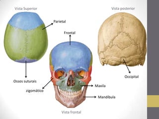 Vista Superior
Vista frontal
Vista posterior
Mandíbula
Frontal
Maxila
Parietal
Occipital
Ossos suturais
zigomático
 