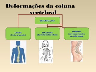 Deformações da coluna
vertebral
DEFORMAÇÕES

CIFOSE
(Costas arqueadas)

ESCOLIOSE
(desvio lateral da coluna)

LORDOSE
(curvatura excessiva
na região lombar

 
