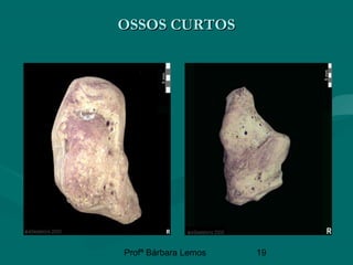 Profª Bárbara Lemos 19
OSSOS CURTOSOSSOS CURTOS
 