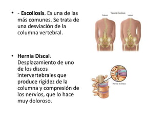 • - Escoliosis. Es una de las
más comunes. Se trata de
una desviación de la
columna vertebral.
• Hernia Discal.
Desplazamiento de uno
de los discos
intervertebrales que
produce rigidez de la
columna y compresión de
los nervios, que lo hace
muy doloroso.
 
