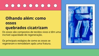 Os ossos são compostos de tecidos vivos e têm uma
incrível capacidade de regeneração.
Os principais estágios de como os ossos se
regeneram e remodelam após uma fratura.
Olhando além: como
ossos
quebrados cicatrizam
 