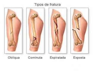 Sistema esquelético e articulações
