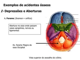 Exemplos de acidentes ósseos
I- Depressões e Aberturas
A. Forame (foramen = orifício)
Ex. forame Magno do
osso Occipital
Abertura no osso onde passam
vasos sangüíneo, nervos ou
ligamentos
Vista superior do assoalho do crânio.
 