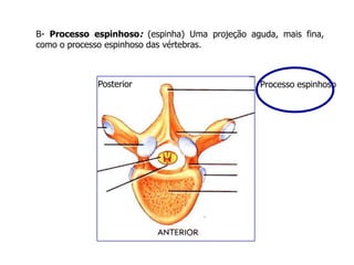 B- Processo espinhoso: (espinha) Uma projeção aguda, mais fina,
como o processo espinhoso das vértebras.
Processo espinhosoPosterior
 
