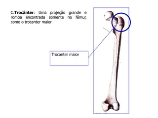 C.Trocânter: Uma projeção grande e
romba encontrada somente no fêmur,
como o trocanter maior
Trocanter maior
 