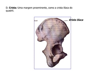 D. Crista: Uma margem proeminente, como a crista ilíaca do
quadril.
Crista ilíaca
 