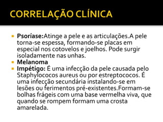  Psoríase:Atinge a pele e as articulações.A pele
torna-se espessa, formando-se placas em
especial nos cotovelos e joelhos. Pode surgir
isoladamente nas unhas.
 Melanoma
 Impétigo: É uma infecção da pele causada pelo
Staphylococos aureus ou por estreptococos. É
uma infecção secundária instalando-se em
lesões ou ferimentos pré-existentes.Formam-se
bolhas frágeis com uma base vermelha viva, que
quando se rompem formam uma crosta
amarelada.
 