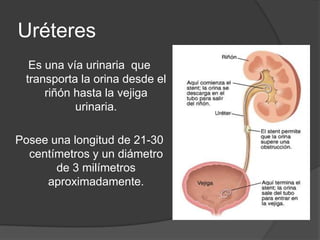 UréteresEs una vía urinaria  que transporta la orina desde el riñón hasta la vejiga urinaria.Posee una longitud de 21-30 centímetros y un diámetro de 3 milímetros aproximadamente.