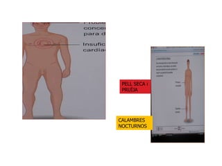 PELL SECA i PRUÏJA CALAMBRES NOCTURNOS 