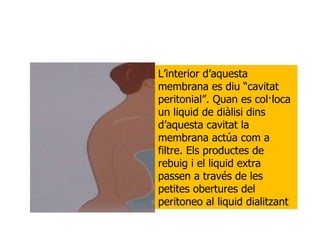 L’interior d’aquesta membrana es diu “cavitat peritonial”. Quan es col·loca un liquid de diàlisi dins d’aquesta cavitat la membrana actúa com a filtre. Els productes de rebuig i el liquid extra passen a través de les petites obertures del peritoneo al liquid dialitzant 