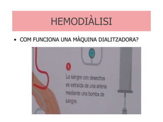 COM FUNCIONA UNA MÀQUINA DIALITZADORA? HEMODIÀLISI 