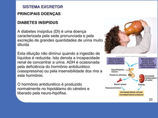 20
SISTEMA EXCRETORSISTEMA EXCRETOR
PRINCIPAIS DOENÇAS
DIABETES INSIPIDUS
A diabetes insipidus (DI) é uma doença
caracterizada pela sede pronunciada e pela
excreção de grandes quantidades de urina muito
diluída
Esta diluição não diminui quando a ingestão de
líquidos é reduzida. Isto denota a incapacidade
renal de concentrar a urina. ADH é ocasionada
pela deficiência do hormônio antidiurético
(vasopressina) ou pela insensibilidade dos rins a
este hormônio.
O hormônio antidiurético é produzido
normalmente no hipotálamo do cérebro e
liberado pela neuro-hipófise.
 