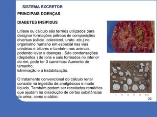 22
SISTEMA EXCRETORSISTEMA EXCRETOR
PRINCIPAIS DOENÇAS
DIABETES INSIPIDUS
Lítíase ou cálculo são termos utilizados para
designar formações pétreas de composições
diversas (cálcio, colesterol, urato, etc.) no
organismo humano em especial nas vias
urinárias e biliares e também nos animais,
podendo levar a doenças . São condensações
(depósitos ) de íons e sais formados no interior
do rim, pode ter 3 caminhos: Aumento de
tamanho,
Eliminação e a Estabilização.
O tratamento convencional do cálculo renal
consiste na ingestão de analgésicos e muito
líquido. Também podem ser receitados remédios
que ajudam na dissolução de certas substâncias
da urina, como o cálcio.
 