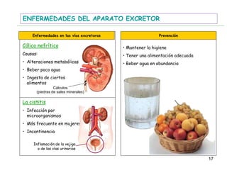 ENFERMEDADES DEL APARATO EXCRETOR
Enfermedades en las vías excretoras Prevención
Cólico nefrítico
Causas:
• Alteraciones metabólicas
• Beber poco agua
• Ingesta de ciertos
alimentos
La cistitis
• Infección por
microorganismos
• Más frecuente en mujeres
• Incontinencia
• Mantener la higiene
• Tener una alimentación adecuada
• Beber agua en abundancia
Cálculos
(piedras de sales minerales)
Inflamación de la vejiga
o de las vías urinarias
17
 