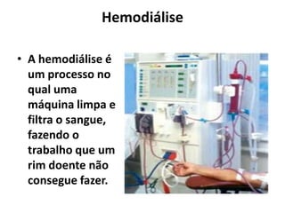 Hemodiálise

• A hemodiálise é
  um processo no
  qual uma
  máquina limpa e
  filtra o sangue,
  fazendo o
  trabalho que um
  rim doente não
  consegue fazer.
 