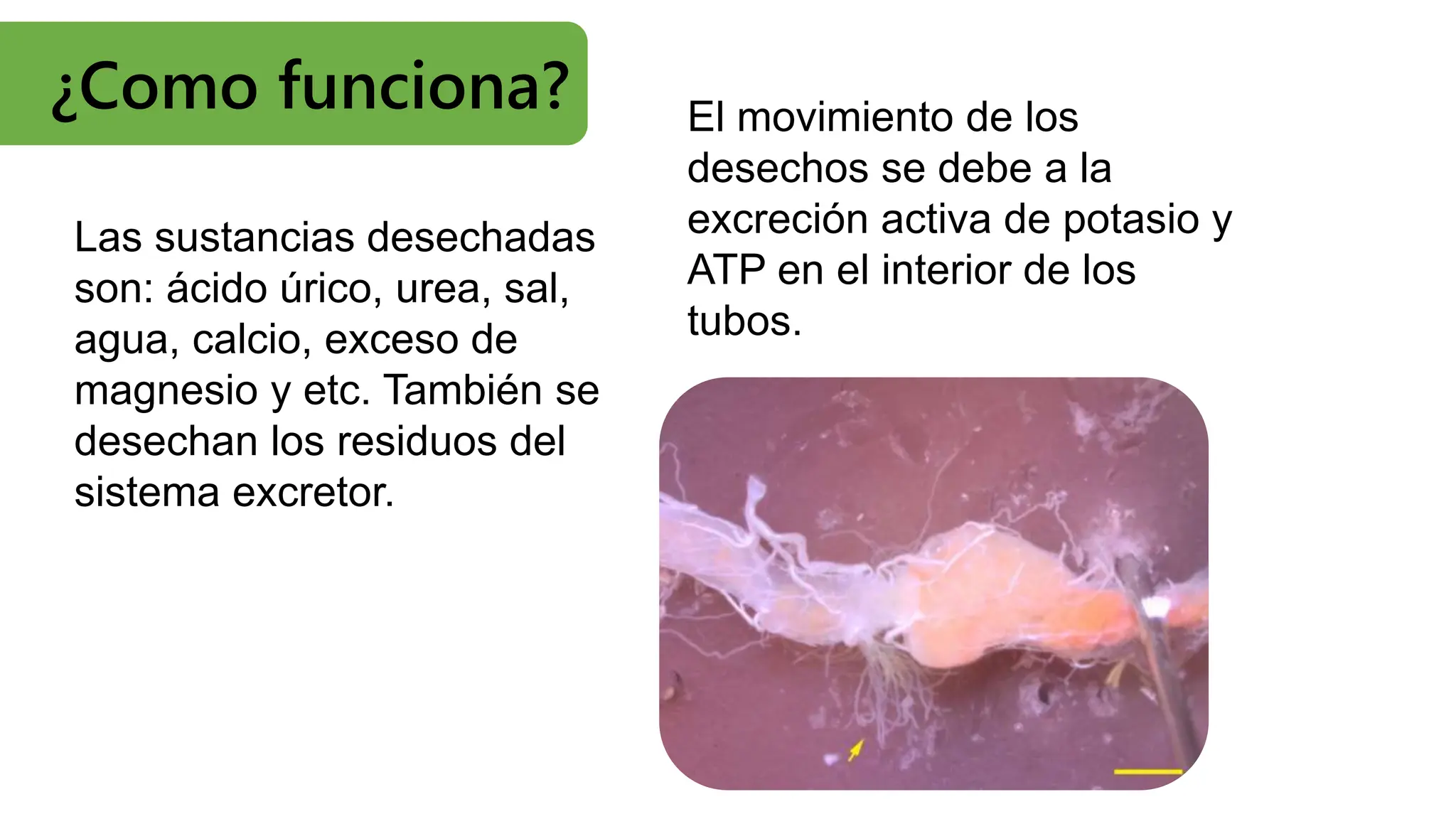 Sistema excretor de los insectos.pptx