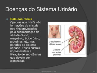 Doenças do Sistema Urinário
 Cálculos renais
("pedras nos rins"): são
formações de cristais
nos rins provocadas
pela sedimentação de
sais de cálcio,
magnésio, ácido úrico,
proteínas, etc, nas
paredes do sistema
urinário. Esses cristais
impossibilitam a
filtração de substâncias
que devem ser
eliminadas.
Ciências Naturais - ICRM 23
 