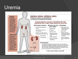 Uremia
Ciências Naturais - ICRM 26
 