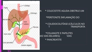  COLECISTITE AGUDA * COLECISTITE AGUDA-OBSTRUI UM
DUCTO
 PERITONITE *PERITONITE INFLAMAÇÃO DO
PERITÔNIO
 * COLEDOCOLITÍASE (CÁLCULOS NO
DUCTO QUE T TRANSPORTA
A BILE);
 *COLANGITE E PAPILITES
(INFLAMAÇÃO DAS VIAS BILIARES); VIAS
 PANCREATITE * PANCREATITE

 