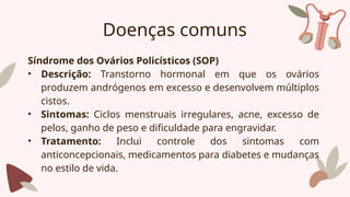 Doenças comuns
Síndrome dos Ovários Policísticos (SOP)
• Descrição: Transtorno hormonal em que os ovários
produzem andrógenos em excesso e desenvolvem múltiplos
cistos.
• Sintomas: Ciclos menstruais irregulares, acne, excesso de
pelos, ganho de peso e dificuldade para engravidar.
• Tratamento: Inclui controle dos sintomas com
anticoncepcionais, medicamentos para diabetes e mudanças
no estilo de vida.
 