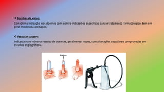 Bombas de vácuo:
Com ótima indicação nos doentes com contra-indicações específicas para o tratamento farmacológico, tem em
geral moderada aceitação.
Vascular surgery:
Indicada num número restrito de doentes, geralmente novos, com alterações vasculares comprovadas em
estudos angiográficos.
 