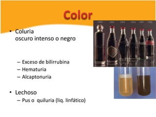 Sistema genitourinario[1] | PPTX