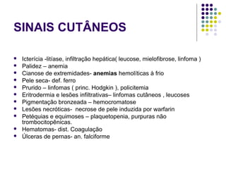 SINAIS CUTÂNEOS
 Icterícia -litíase, infiltração hepática( leucose, mielofibrose, linfoma ) 
 Palidez – anemia 
 Cianose de extremidades- anemias hemolíticas à frio 
 Pele seca- def. ferro 
 Prurido – linfomas ( princ. Hodgkin ), policitemia 
 Eritrodermia e lesões infiltrativas– linfomas cutâneos , leucoses 
 Pigmentação bronzeada – hemocromatose 
 Lesões necróticas-  necrose de pele induzida por warfarin 
 Petéquias e equimoses – plaquetopenia, purpuras não 
trombocitopênicas. 
 Hematomas- dist. Coagulação 
 Úlceras de pernas- an. falciforme 
 