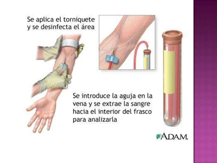 Sistema Hematopoyetico