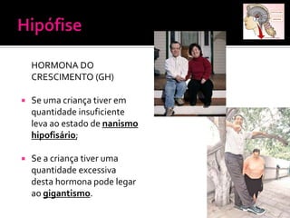 HORMONA DO
    CRESCIMENTO (GH)

   Se uma criança tiver em
    quantidade insuficiente
    leva ao estado de nanismo
    hipofisário;

   Se a criança tiver uma
    quantidade excessiva
    desta hormona pode legar
    ao gigantismo.
 