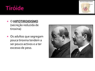    O HIPOTIROIDISMO
    (secreção reduzida de
    tiroxina)

   Os adultos que segregam
    pouca tiroxina tendem a
    ser pouco activos e a ter
    excesso de peso.
 