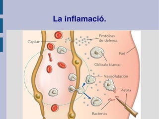 La inflamació.
 